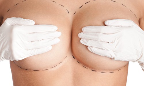 Breast Enlargement Without Surgery