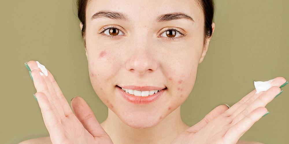 Types of Acne Treatments