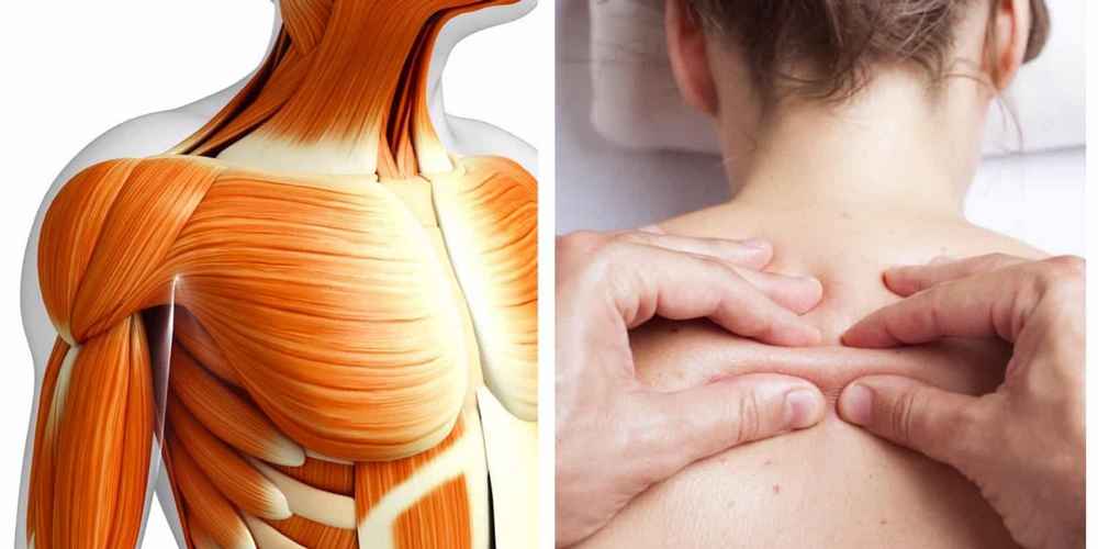 Causes of Muscle Pain